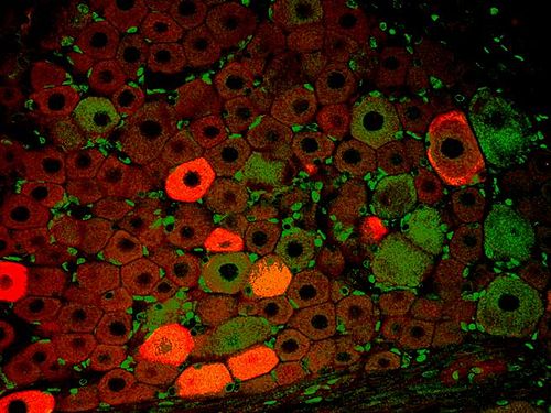 Immunfluoreszenz-Aufnahme im Spinalganglion der Ratte. Zwei verschiedene Proteine wurden mit rot oder grün fluoreszierenden Markern gefärbt.